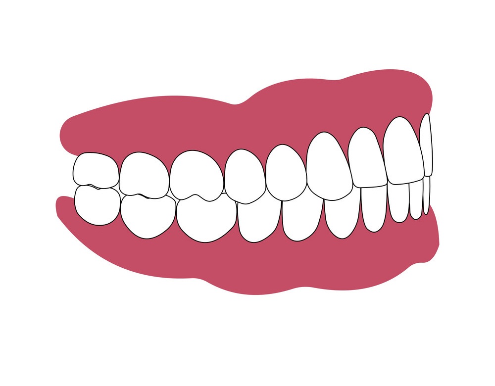 歯と歯茎のイラスト イラスト